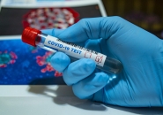 Coronavirus: Conficoni (Pd), su tamponi Fvg lavora sotto le sue potenzialità, pordenonese penalizzato